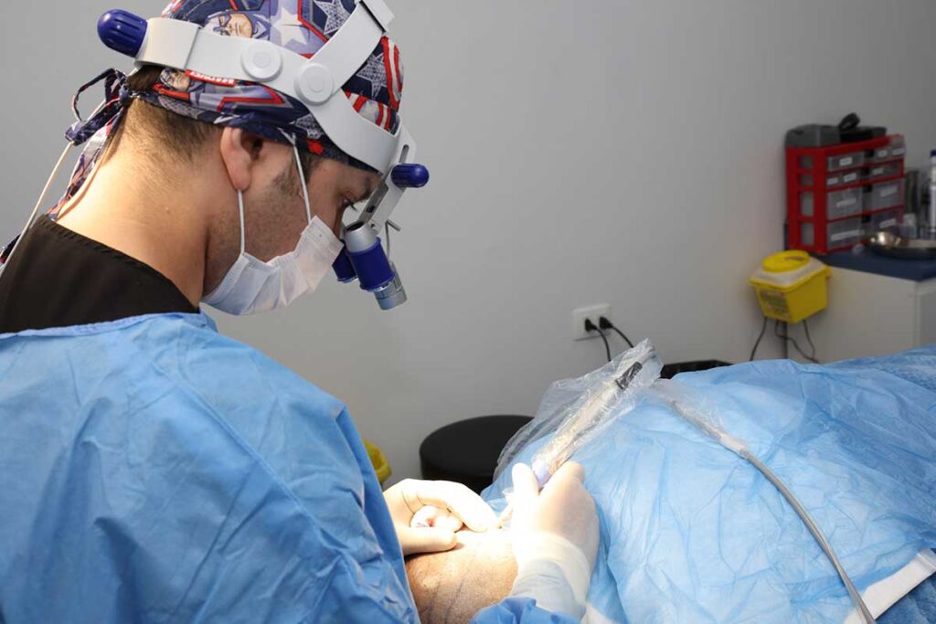 Dr. Bravo Crisóstomo realizando una cirugía capilar