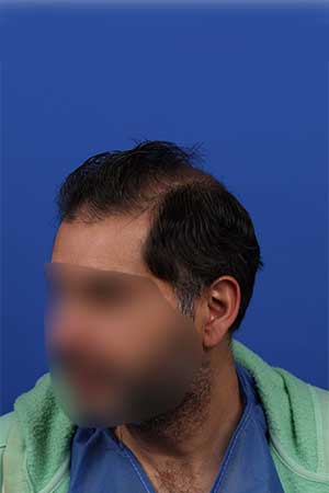 Antes